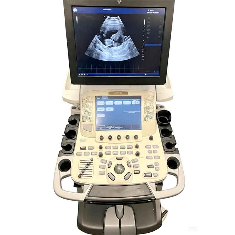 Refurbished GE Vivid E9 Trolley‑Type 4D Cardiovascular Ultrasound System