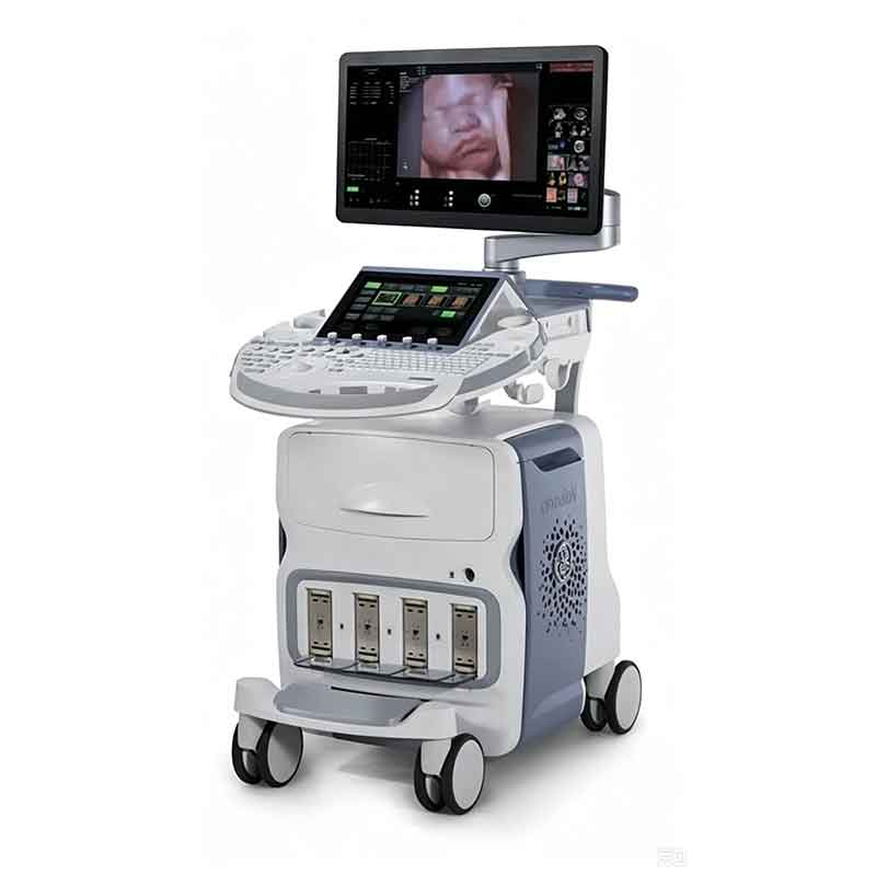 Refurbished GE Voluson E8 Trolley-Type 4D OB/GYN Ultrasound System
