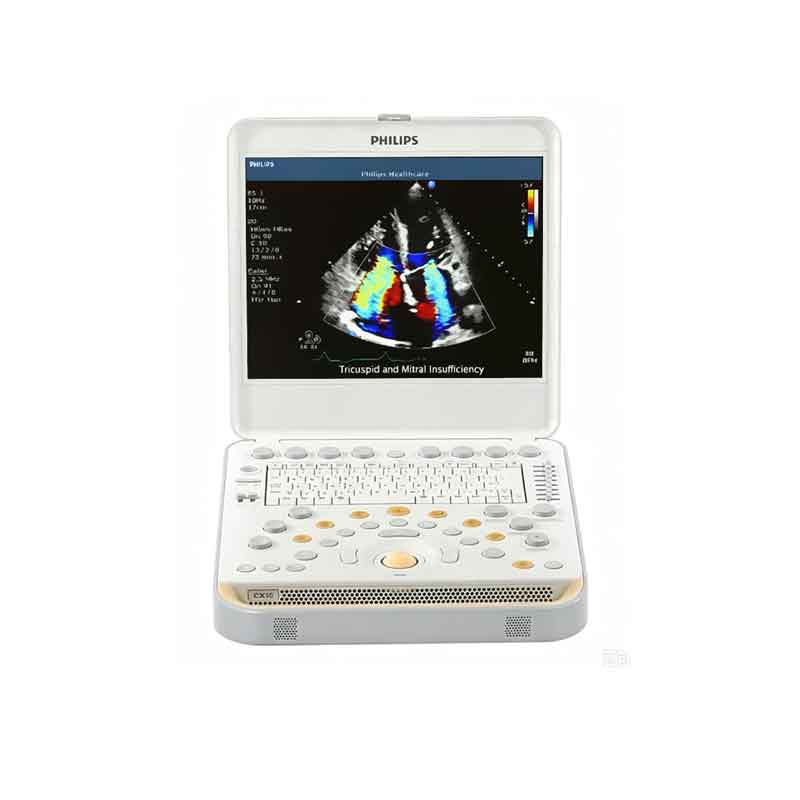 Refurbished Philips CX50 Portable Ultrasound System