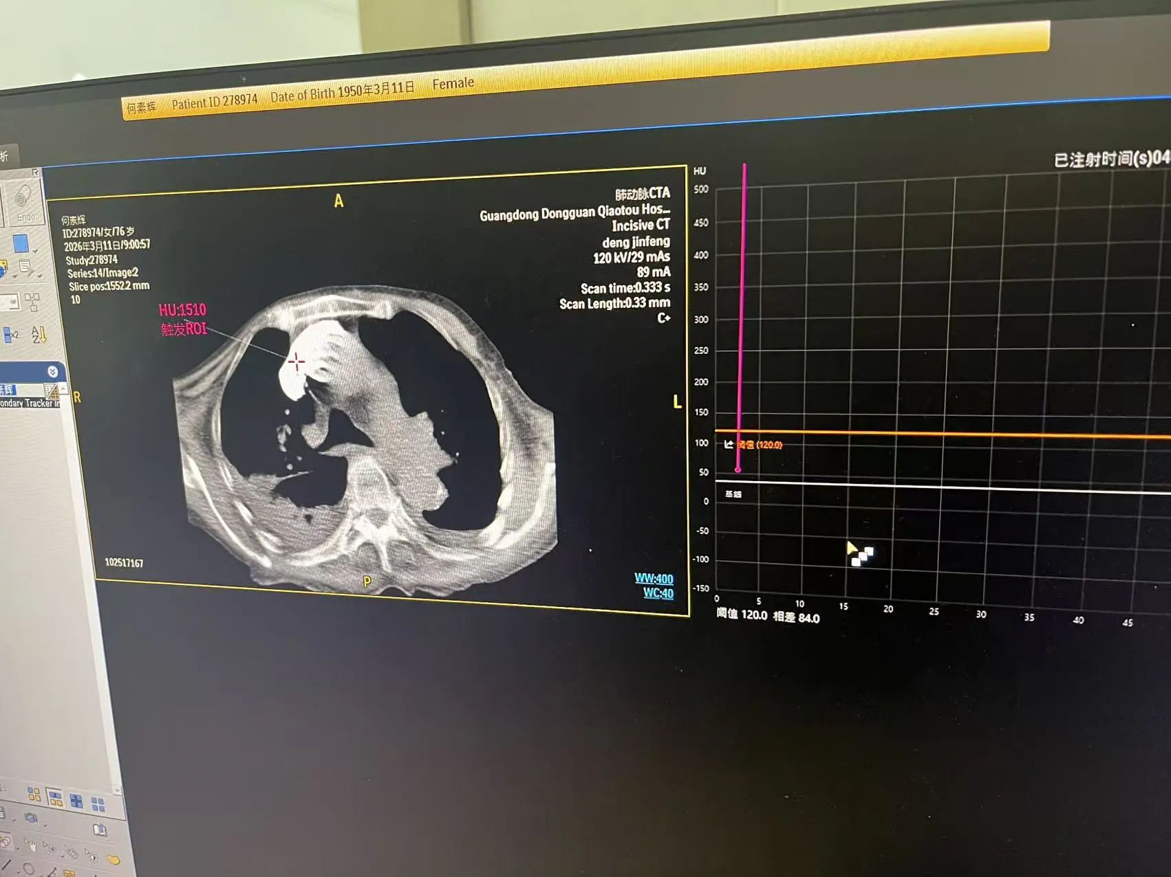 Philips Incisive CT Power System Service and Technical Support Project — project image 7 thumbnail
