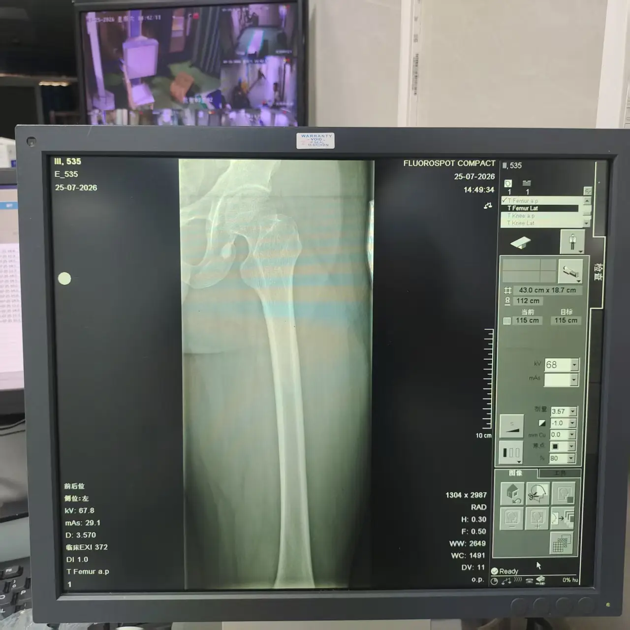 Siemens YSIO DR System Inspection and Service Project — project image 9 thumbnail